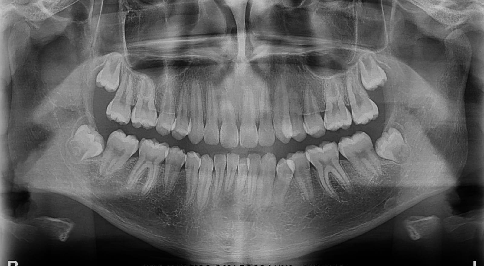 Radiografía Panorámica
